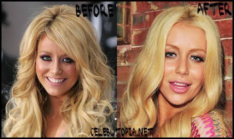 Aubrey O'day Plastic Surgery - Danity Kane